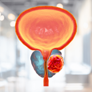 การตรวจมะเร็งต่อมลูกหมากด้วยการตัดชิ้นเนื้อ TRUS C BX