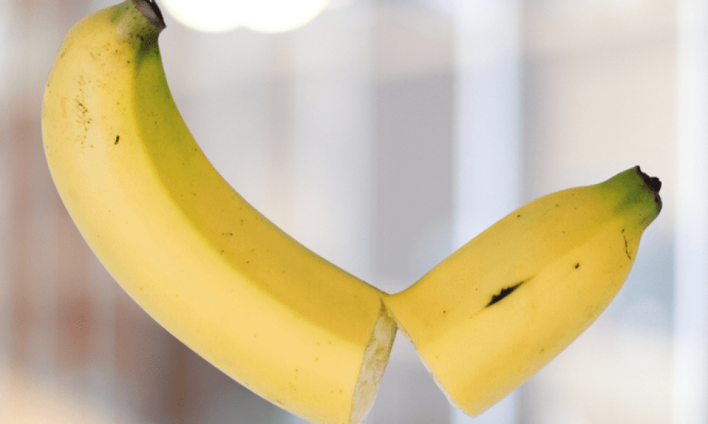 อวัยวะเพศ โค้ง งอ ผิดรูป Peyronie’s disease