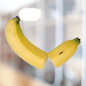 อวัยวะเพศ โค้ง งอ ผิดรูป Peyronie’s disease